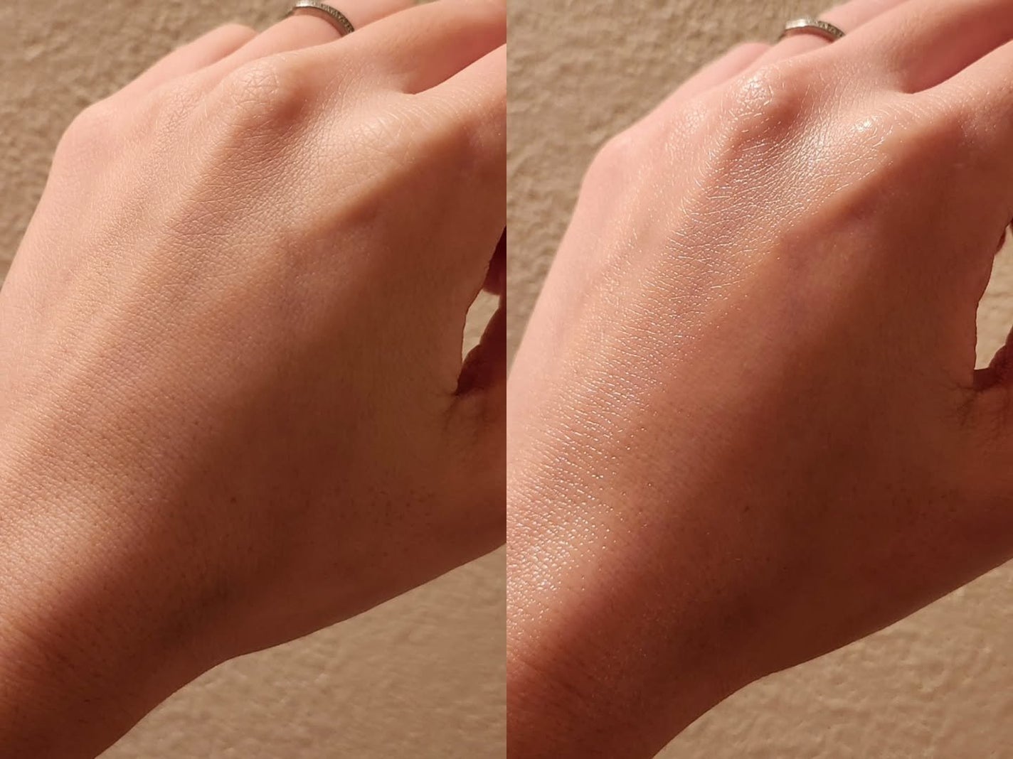 リポソーム リペア インテンシブ クリーム/shaishaishai/フェイスクリームを使ったクチコミ(5枚目)