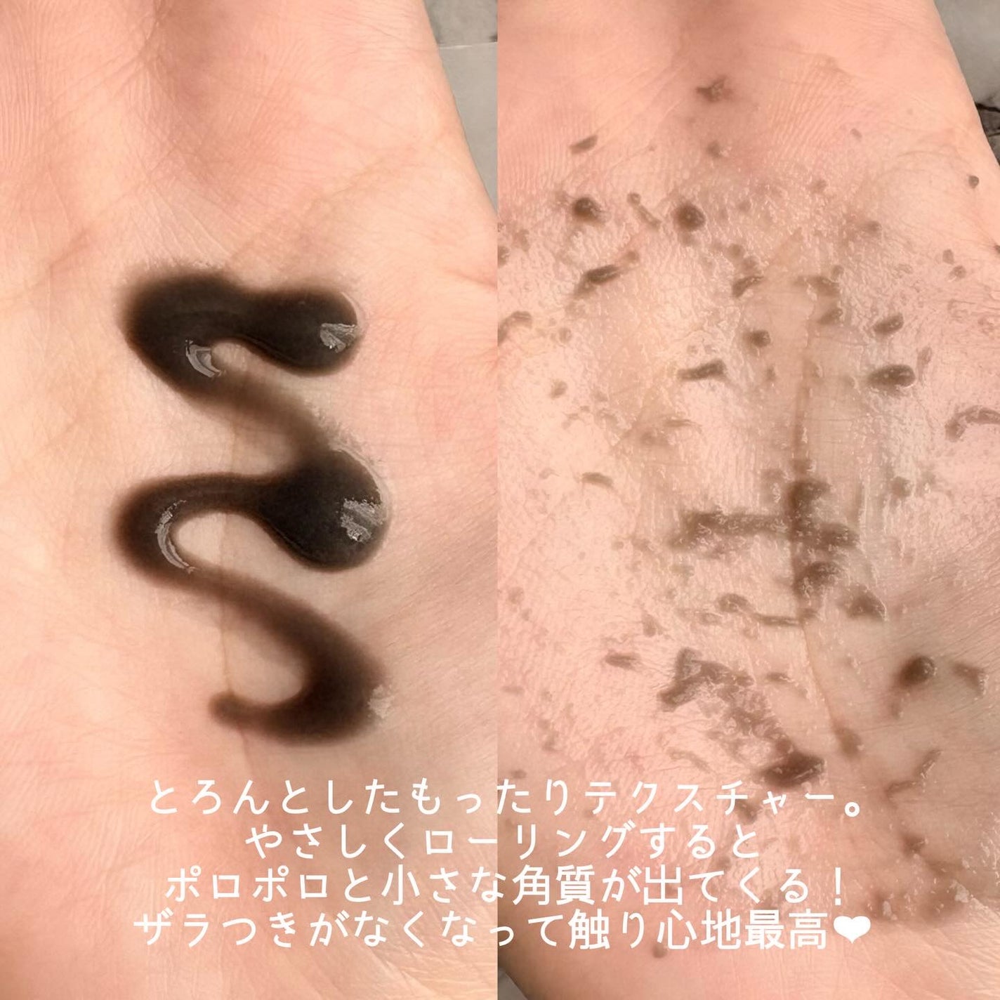 白米ピーリングアンプル/mixsoon/ピーリングを使ったクチコミ(5枚目)