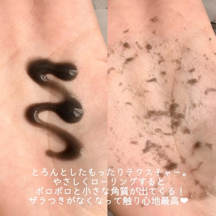 白米ピーリングアンプル/mixsoon/ピーリングを使ったクチコミ(5枚目)