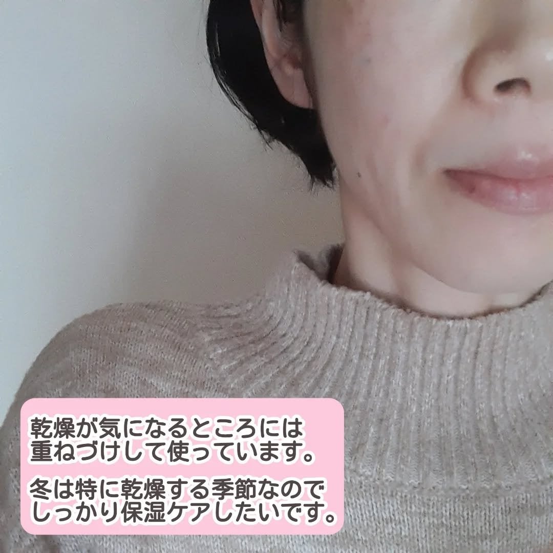 リッチ ローション/イオナ エフ/化粧水を使ったクチコミ(4枚目)