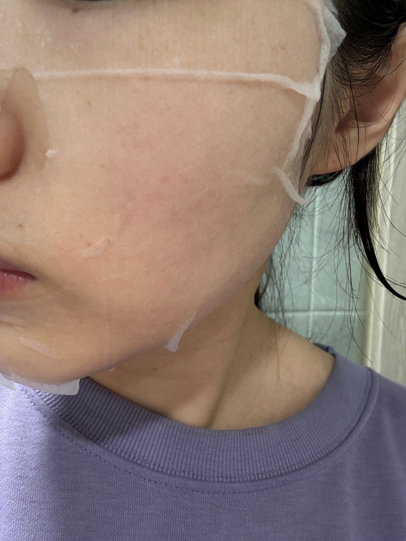 ドクダミシートマスクデイリーピック/Abib /シートマスク・パックを使ったクチコミ(4枚目)