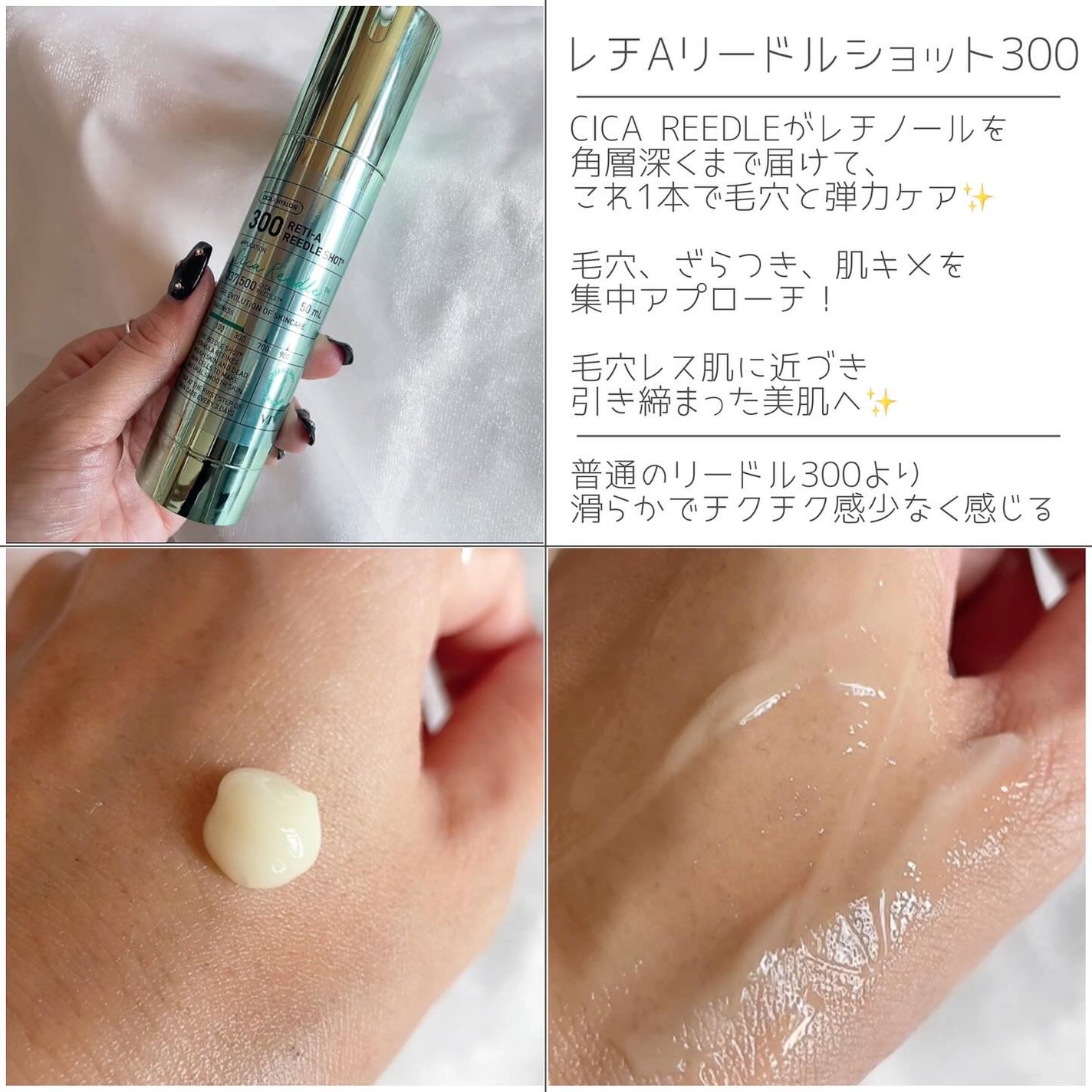 シカレチA クリーム0.05/VT/フェイスクリームを使ったクチコミ(4枚目)