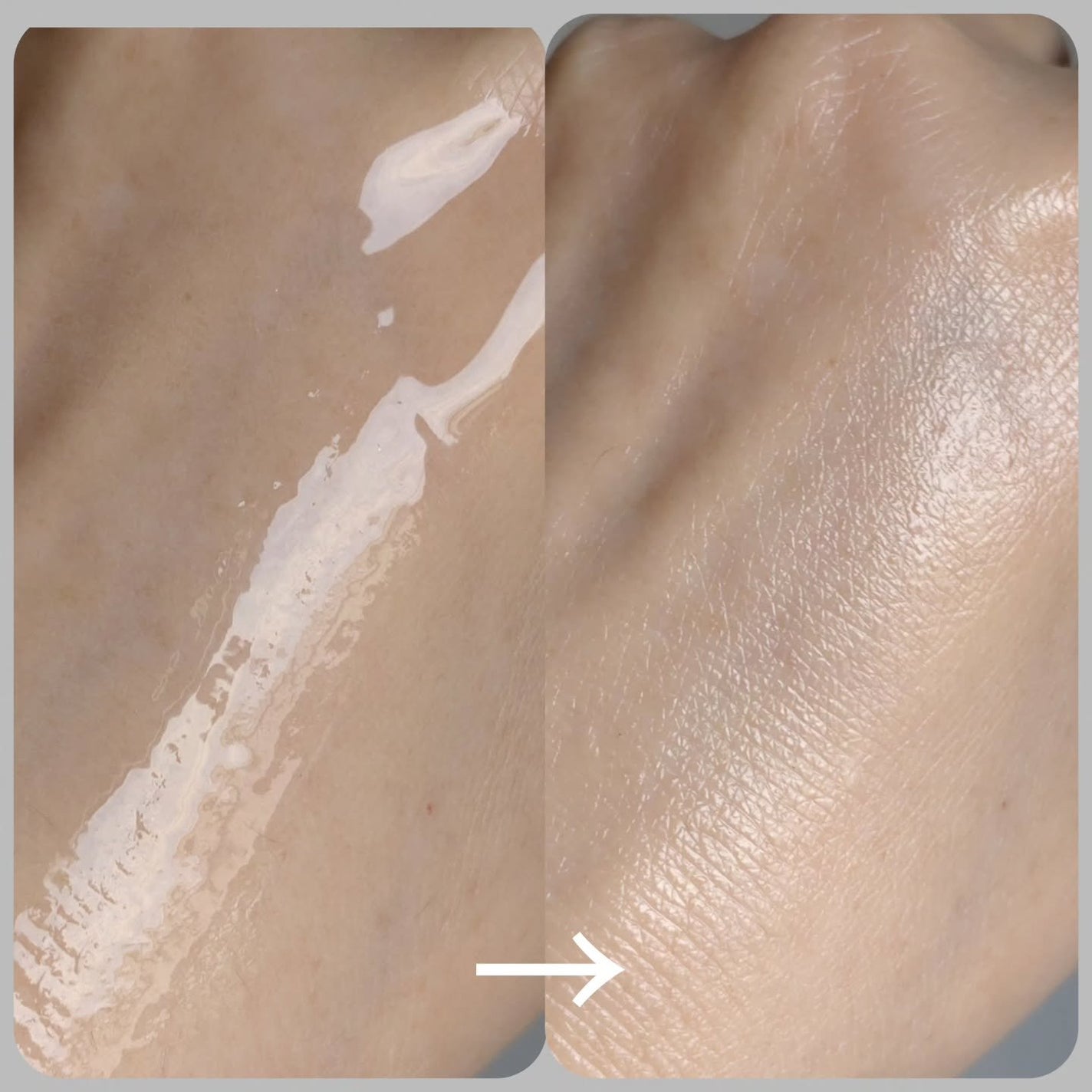 ジェニフィック アルティメ セラム/LANCOME/美容液を使ったクチコミ(7枚目)