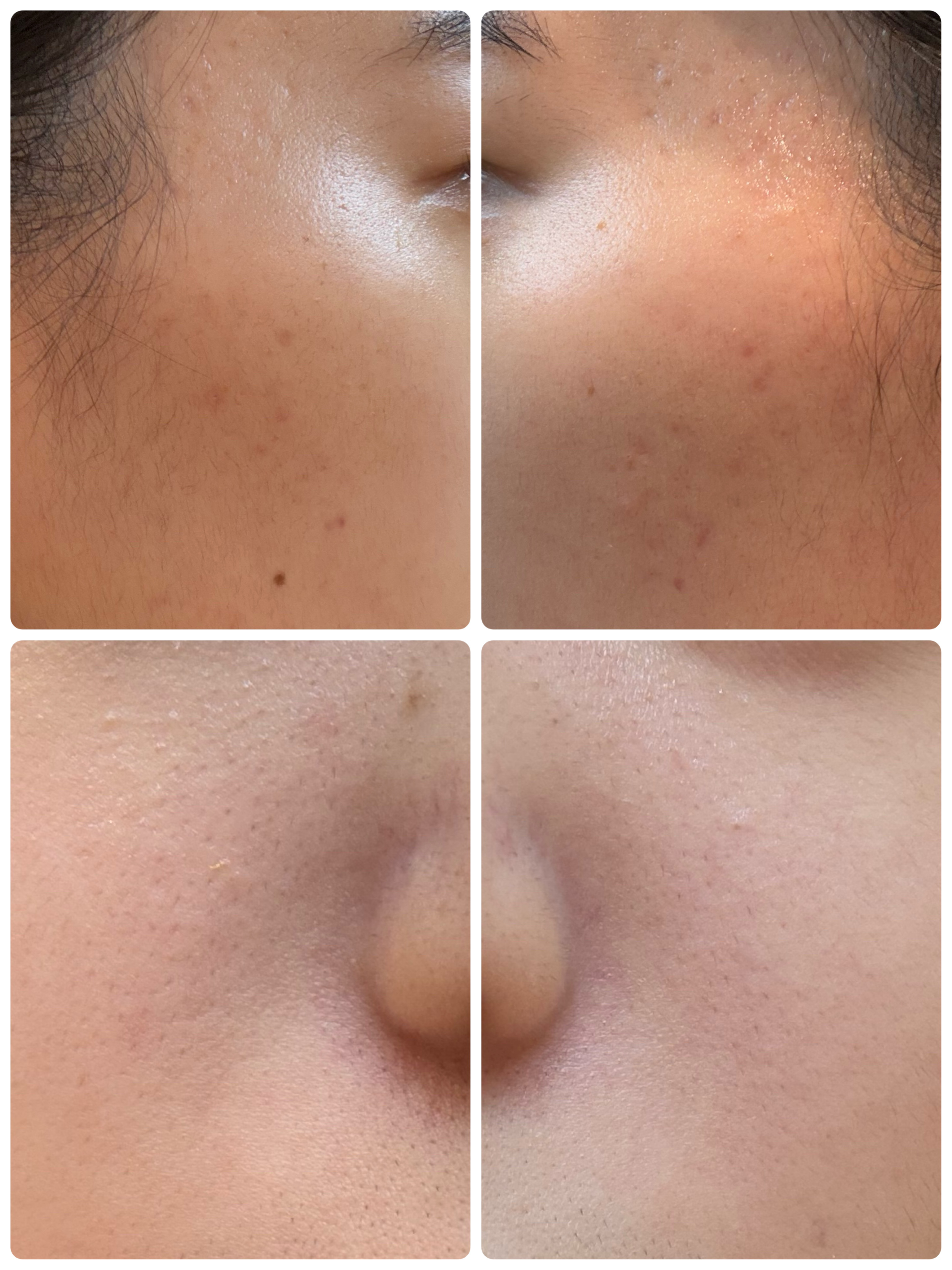 モーニングジェルウォッシュ/ビトレスキン/その他洗顔料を使ったクチコミ（2枚目）