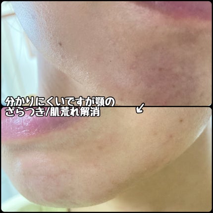 AZケア トナー/VT/化粧水を使ったクチコミ(3枚目)