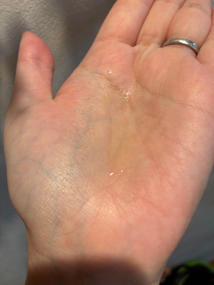 アデノバイタル スカルプ パワーショット/サブリミック/頭皮ローションを使ったクチコミ(5枚目)