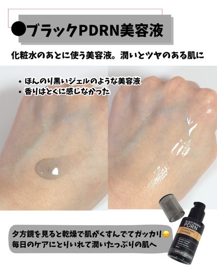 ブラックPDRN 美容液/ネイチャーリパブリック/美容液を使ったクチコミ(3枚目)
