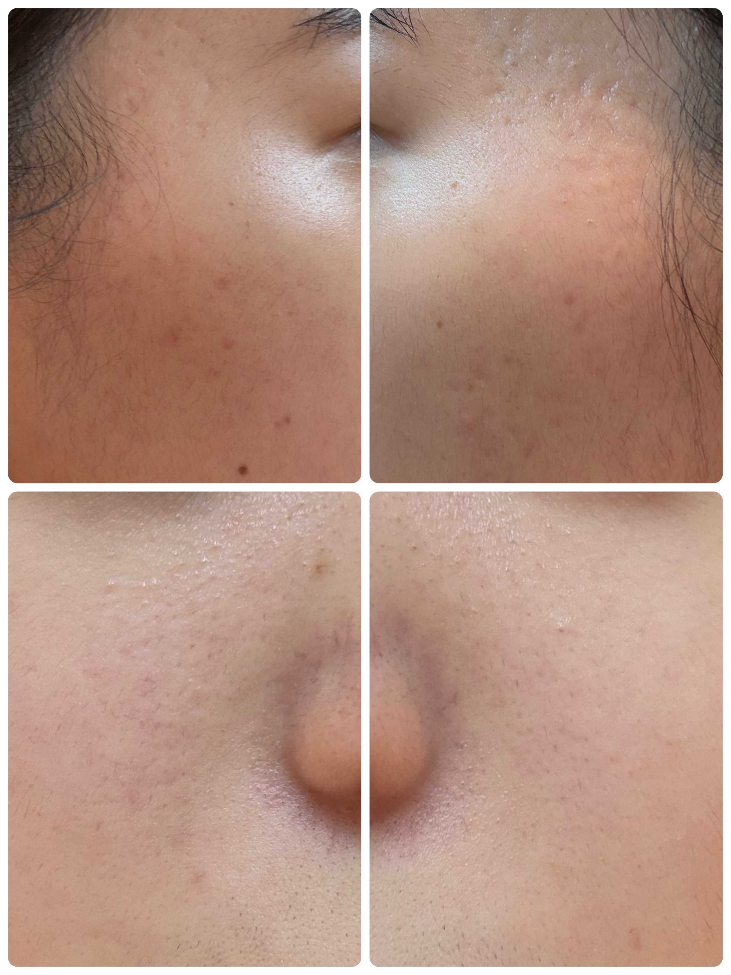 AGE-R ブースタープロ/MEDICUBE/美顔器・マッサージを使ったクチコミ（2枚目）