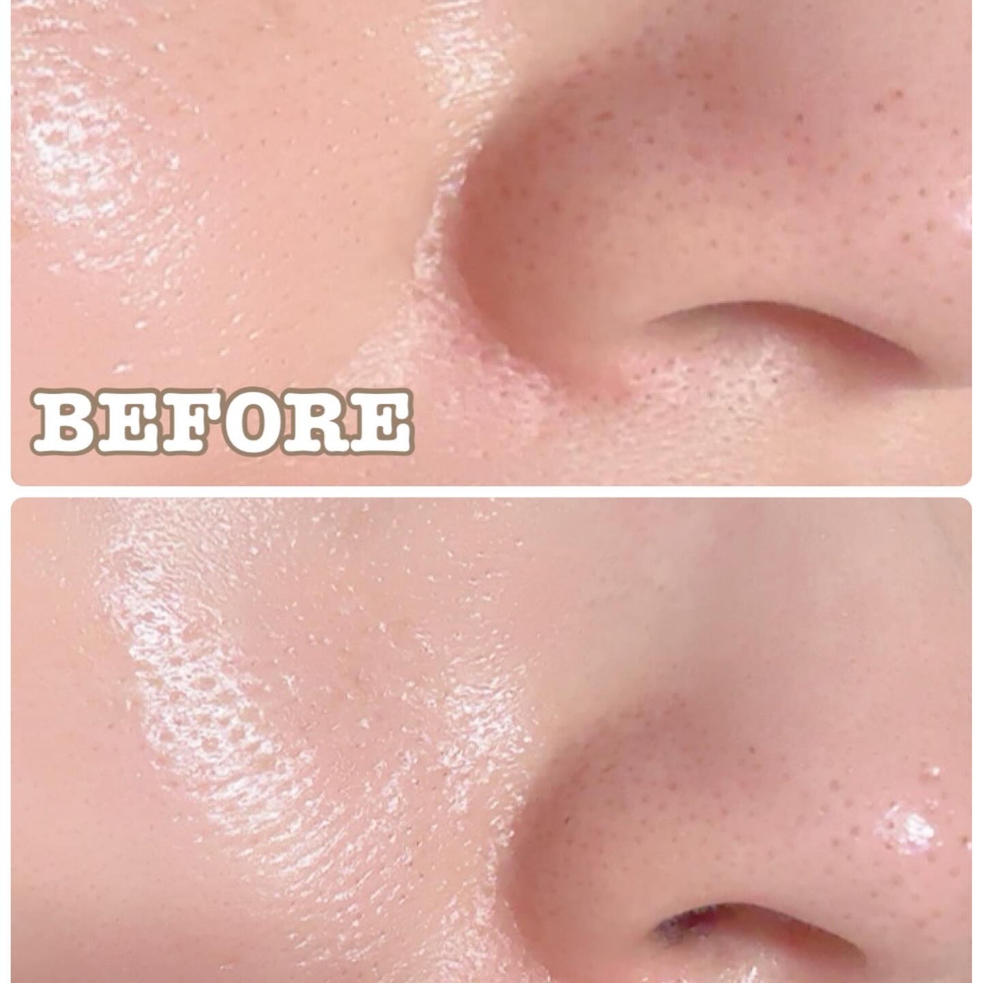 AZケア トナー/VT/化粧水を使ったクチコミ(4枚目)