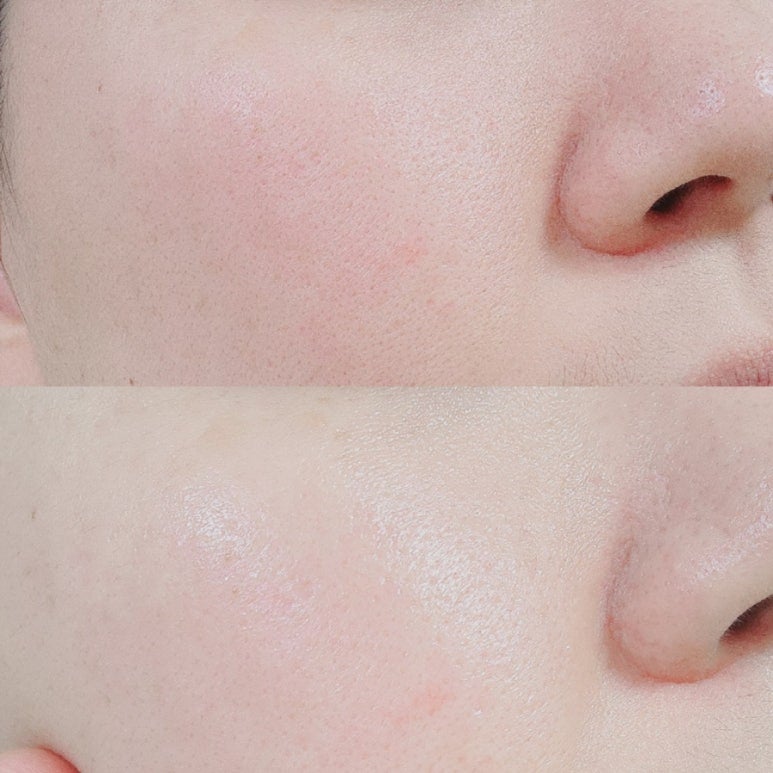 ユキのビューティー勉強部屋 on LIPS 「🍑SNSで話題!毛穴・透明感・水光肌を叶える「アヌア桃セラム」..」(5枚目)