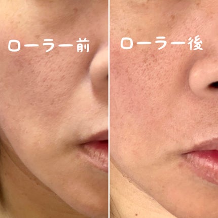 を使ったクチコミ(2枚目)