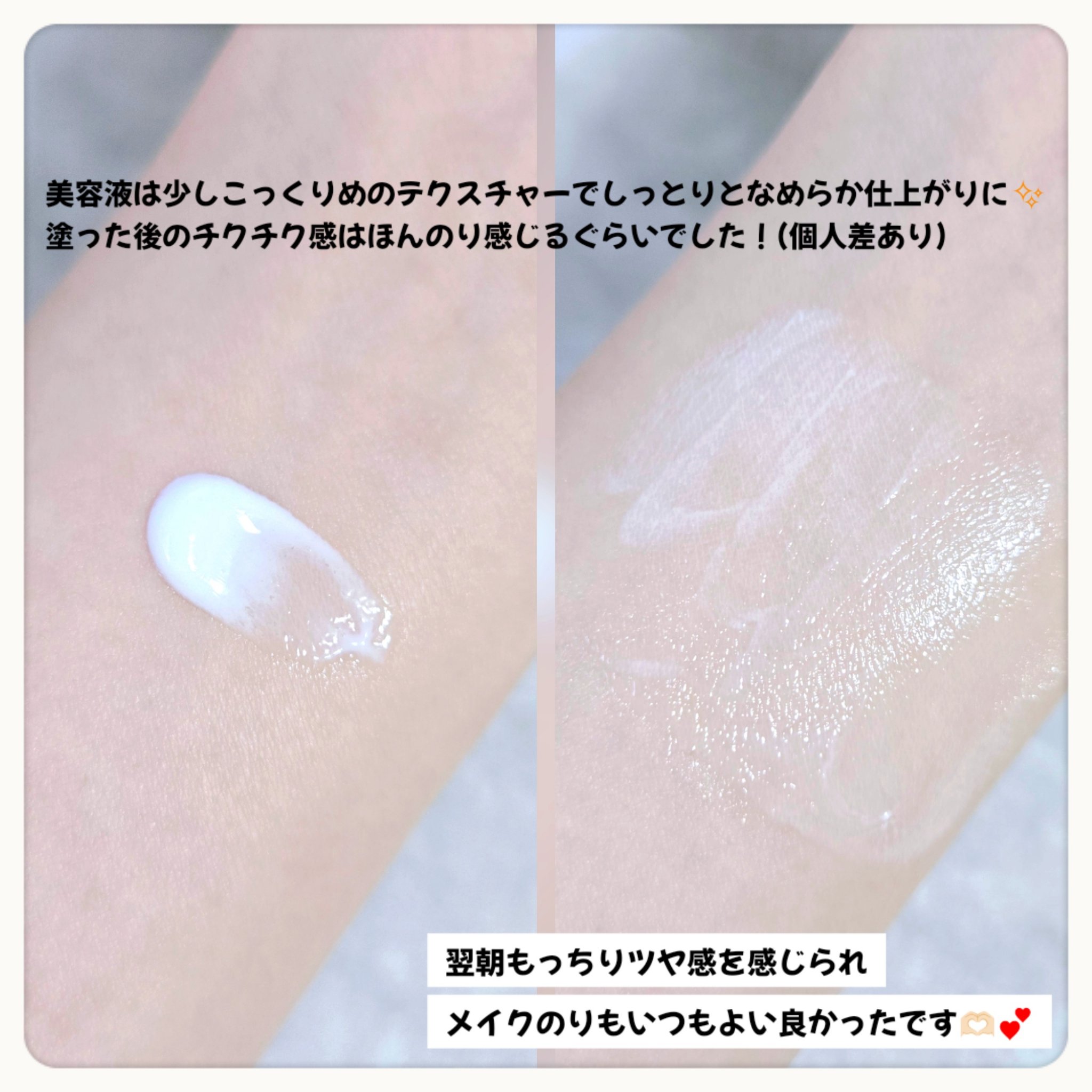 リードルショット100/VT/美容液を使ったクチコミ（3枚目）