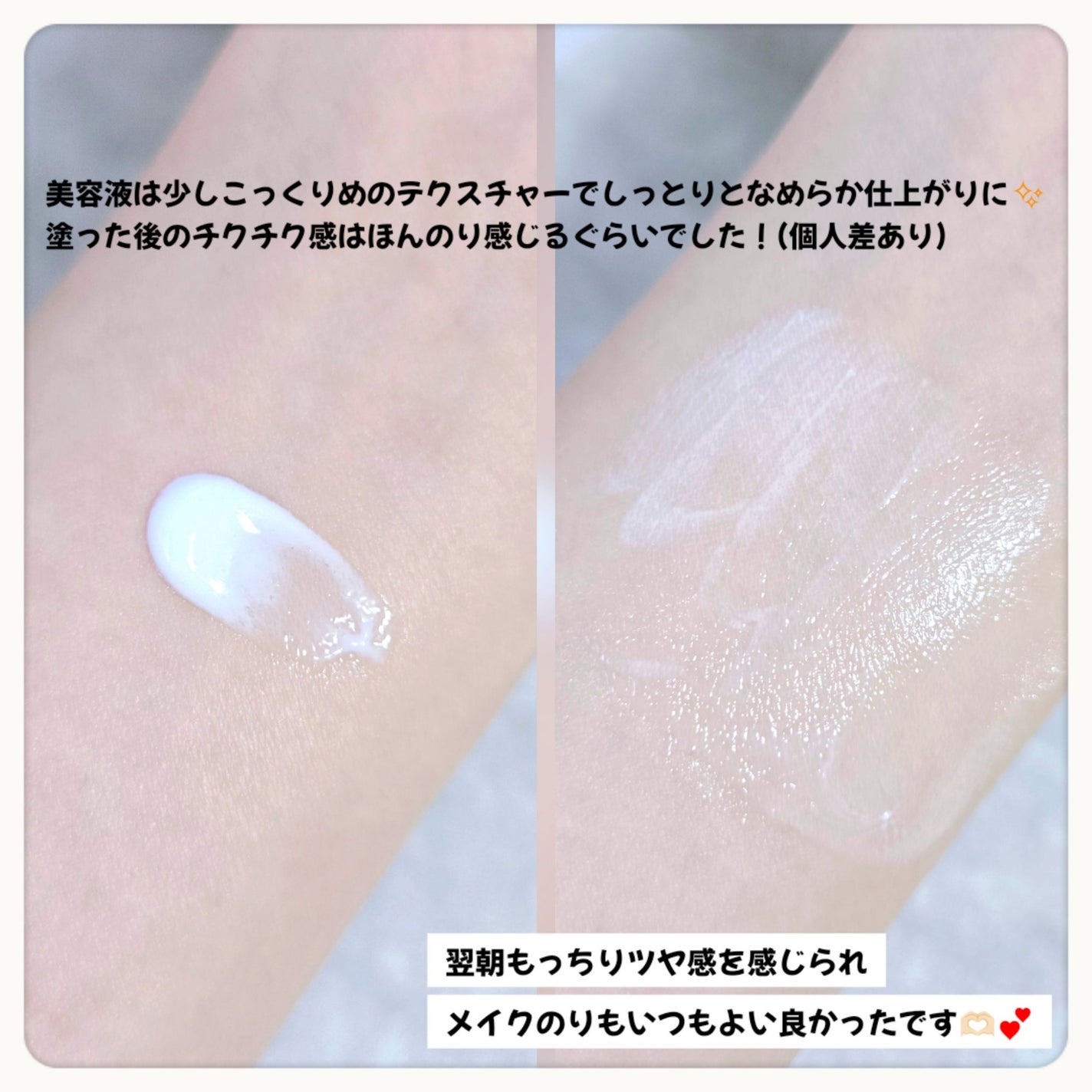 リードルショット100/VT/美容液を使ったクチコミ(3枚目)