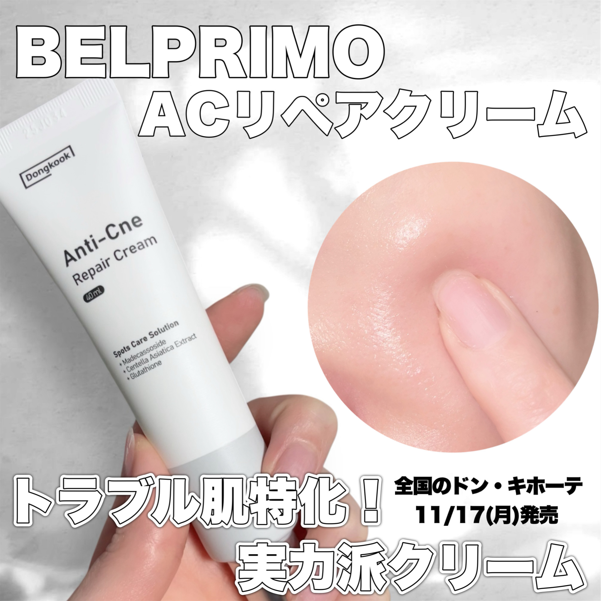 <PR>【BELPRIMO｜ACリペアクリーム】

こちらの商品はBELPRIMO様よりご提供いただきました。


BELPRIMOさんは韓国の傷薬づくりで有名な製薬会社が作った、トラブル肌に本気で向き合うスキンケアブランド✨
発売1ヶ月で