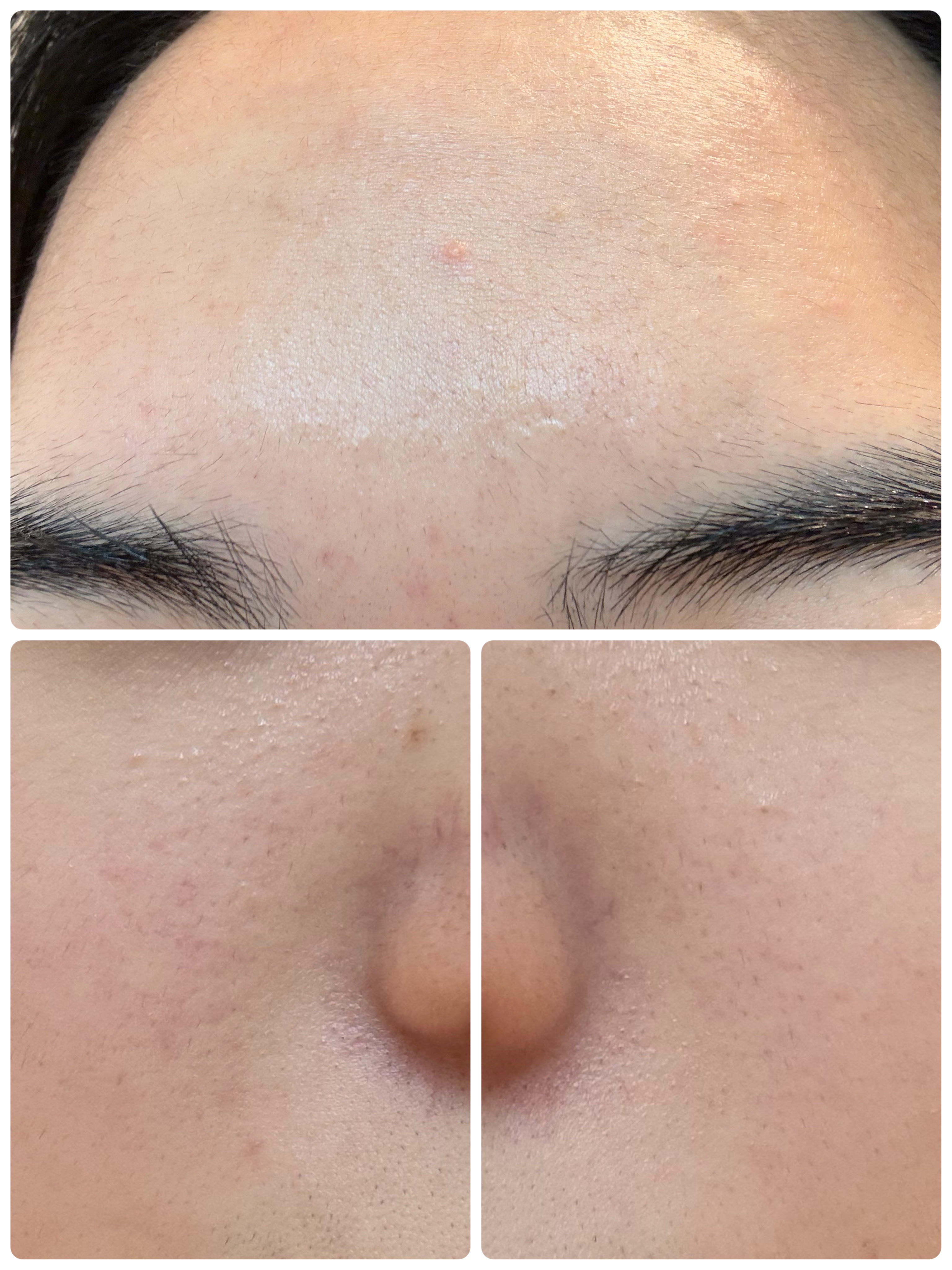 AGE-R ブースタープロ/MEDICUBE/美顔器・マッサージを使ったクチコミ（3枚目）