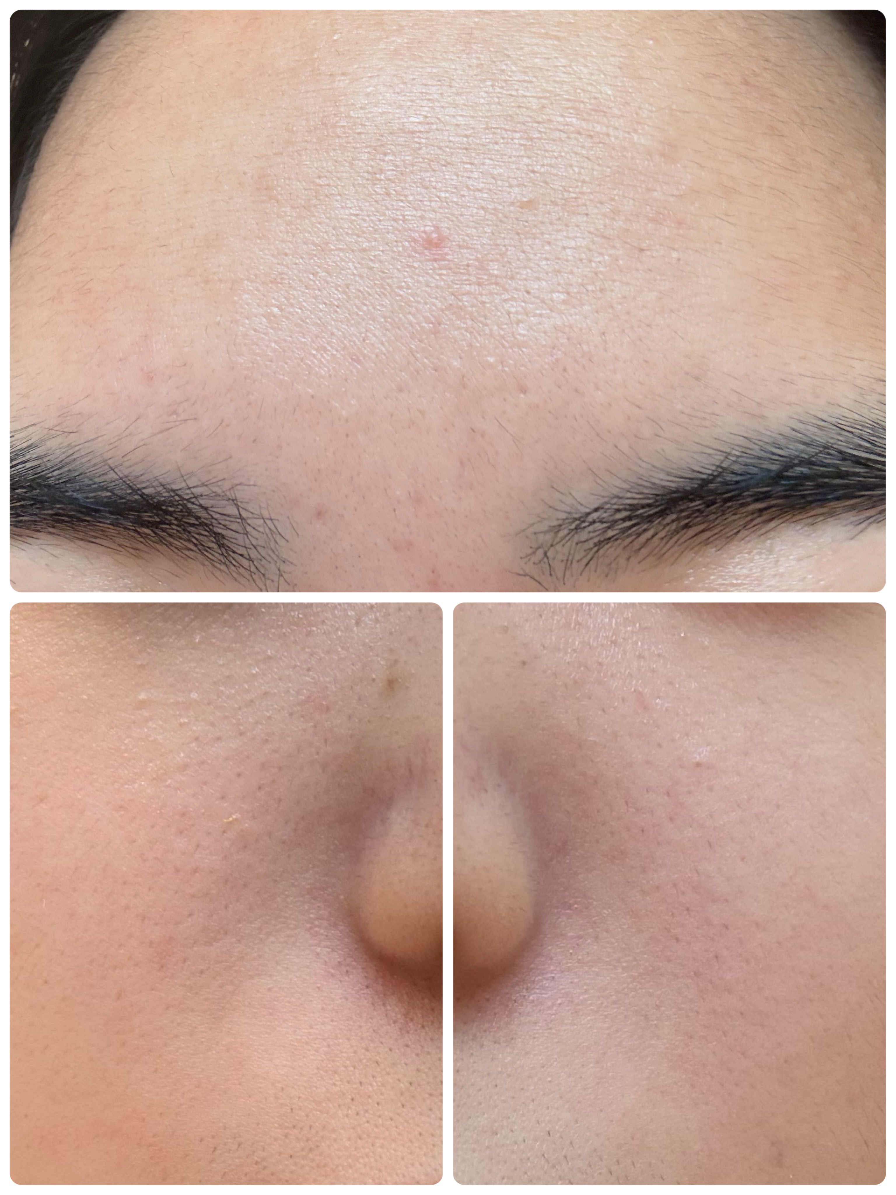 モーニングジェルウォッシュ/ビトレスキン/その他洗顔料を使ったクチコミ（3枚目）