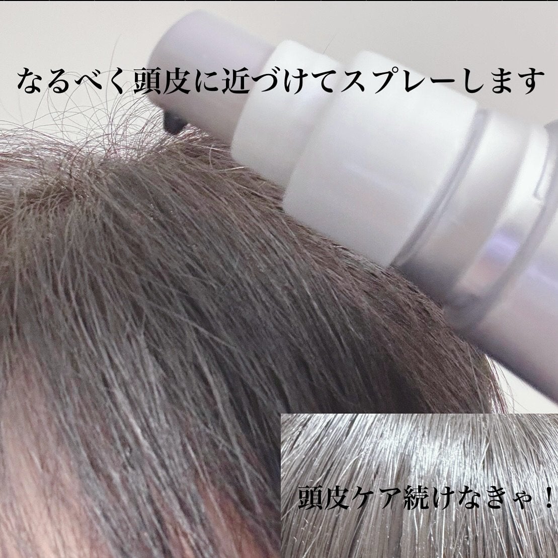 アデノバイタル スカルプ パワーショット/サブリミック/頭皮ローションを使ったクチコミ(5枚目)