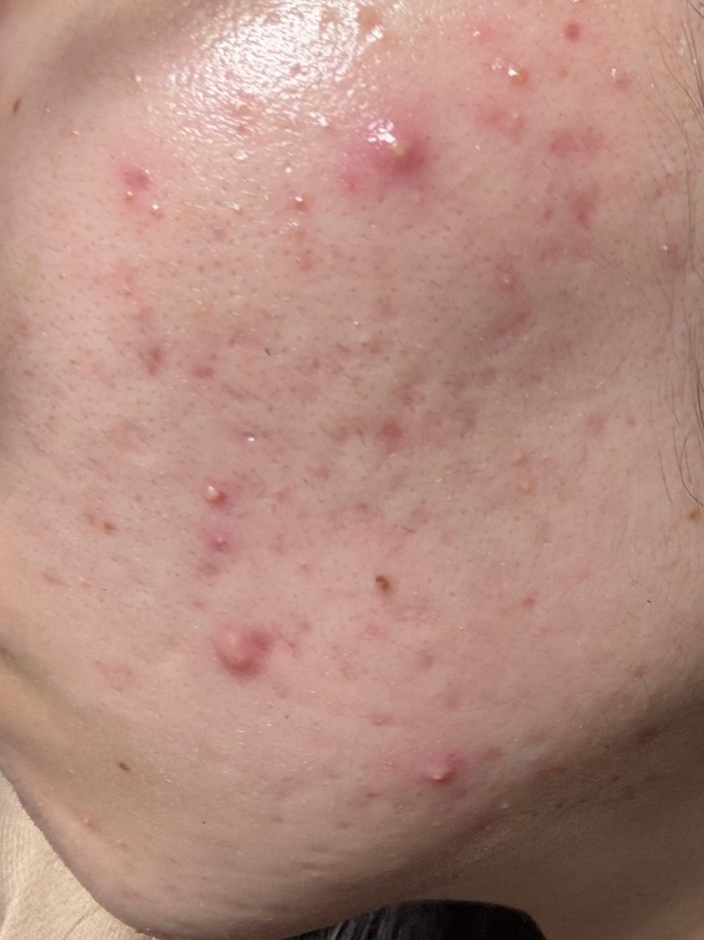 5番 白玉グルタチオンC美容液/numbuzin/美容液を使ったクチコミ(2枚目)