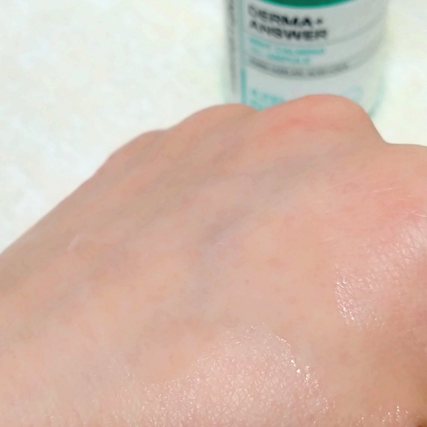 ダーマアンサーアゼライン酸ミントアンプル/CNP Laboratory/美容液を使ったクチコミ(5枚目)