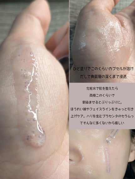 プラセンタビタセラム/MEDICUBE/美容液を使ったクチコミ(4枚目)