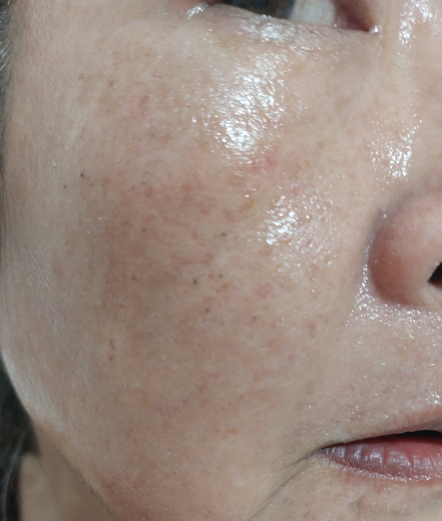 ヴィーガンコンブチャ ティー エッセンス/Dr.Ceuracle/オールインワン化粧品を使ったクチコミ(5枚目)