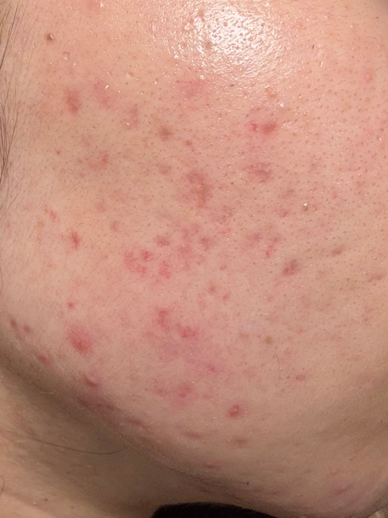 5番 白玉グルタチオンC美容液/numbuzin/美容液を使ったクチコミ(1枚目)