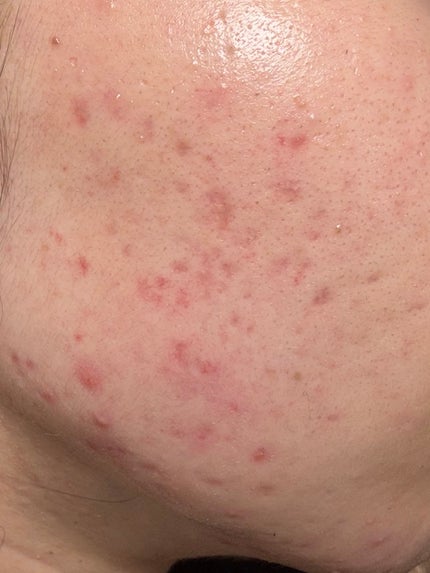 5番 白玉グルタチオンC美容液/numbuzin/美容液を使ったクチコミ(1枚目)