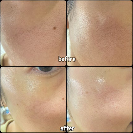 AZケア トナー/VT/化粧水を使ったクチコミ(4枚目)