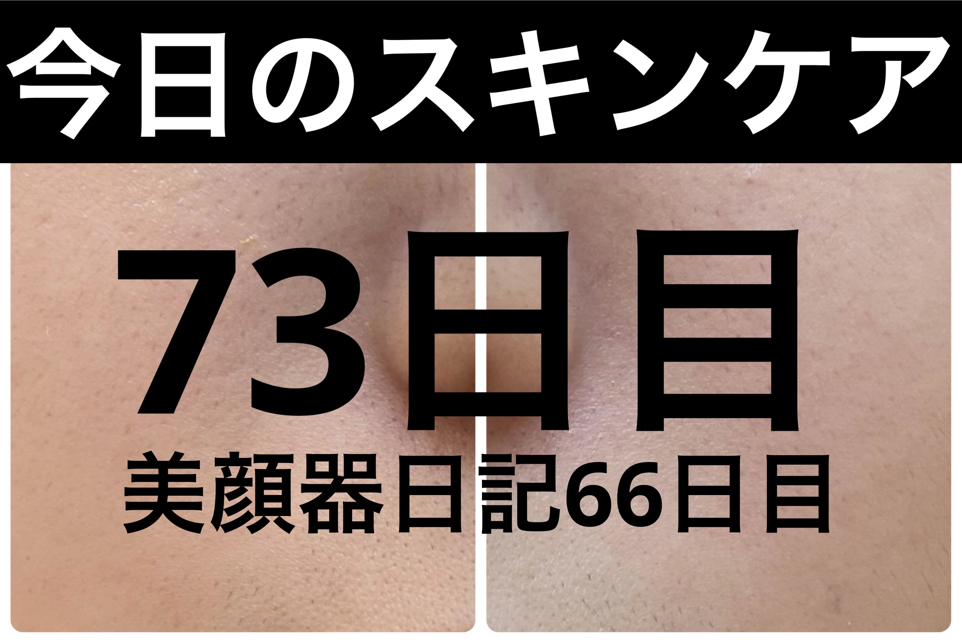 モーニングジェルウォッシュ/ビトレスキン/その他洗顔料を使ったクチコミ（1枚目）