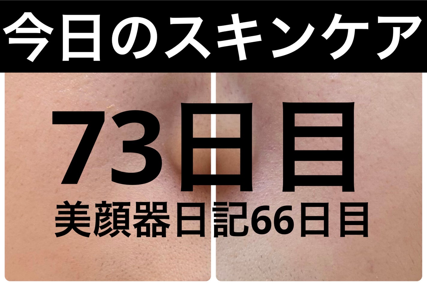 モーニングジェルウォッシュ/ビトレスキン/その他洗顔料を使ったクチコミ(1枚目)