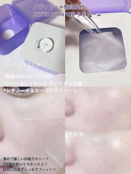 PDRN リフティングマスク/MEDIHEAL/シートマスク・パックを使ったクチコミ(2枚目)