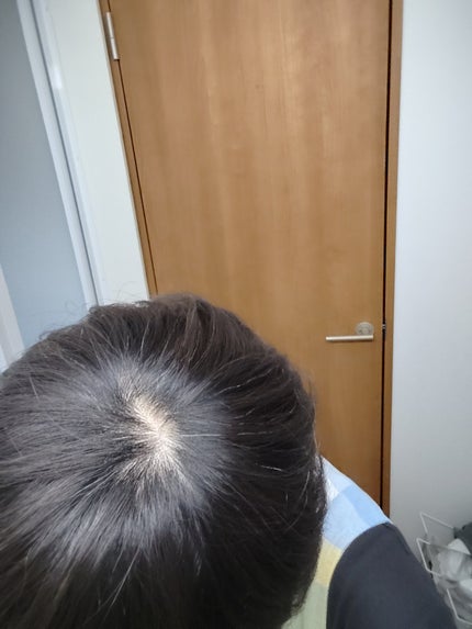 ホイップヘアカラー/ビューティラボ/ヘアカラーを使ったクチコミ(4枚目)