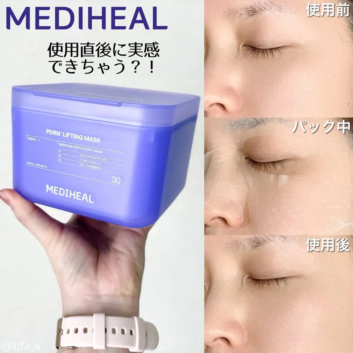 PDRN リフティングマスク/MEDIHEAL/シートマスク・パックを使ったクチコミ(4枚目)