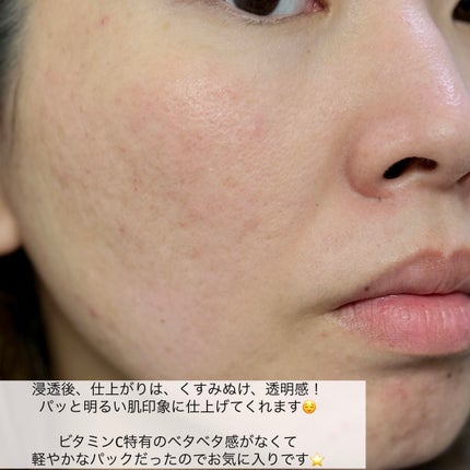 ビタミンC(*⁶)パンテノールマスク/MIJIN COSMETICS/シートマスク・パックを使ったクチコミ(8枚目)