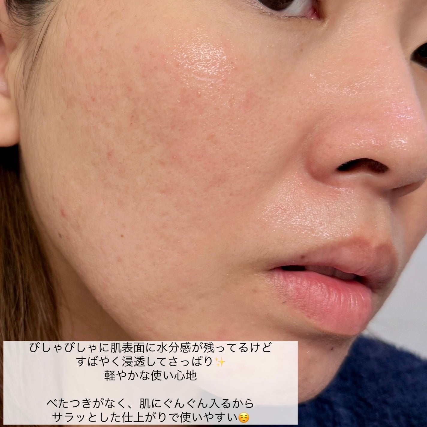 ビタミンC(*⁶)パンテノールマスク/MIJIN COSMETICS/シートマスク・パックを使ったクチコミ(6枚目)