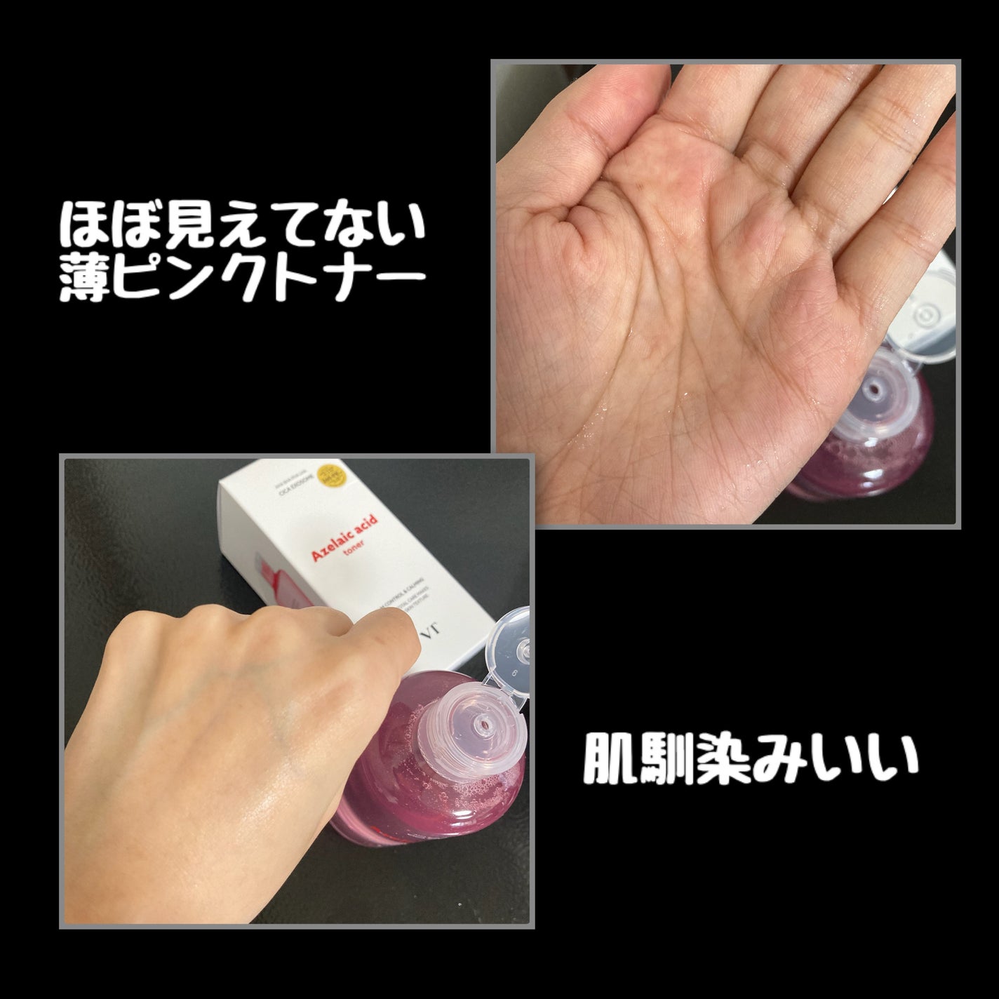 AZケア トナー/VT/化粧水を使ったクチコミ(2枚目)