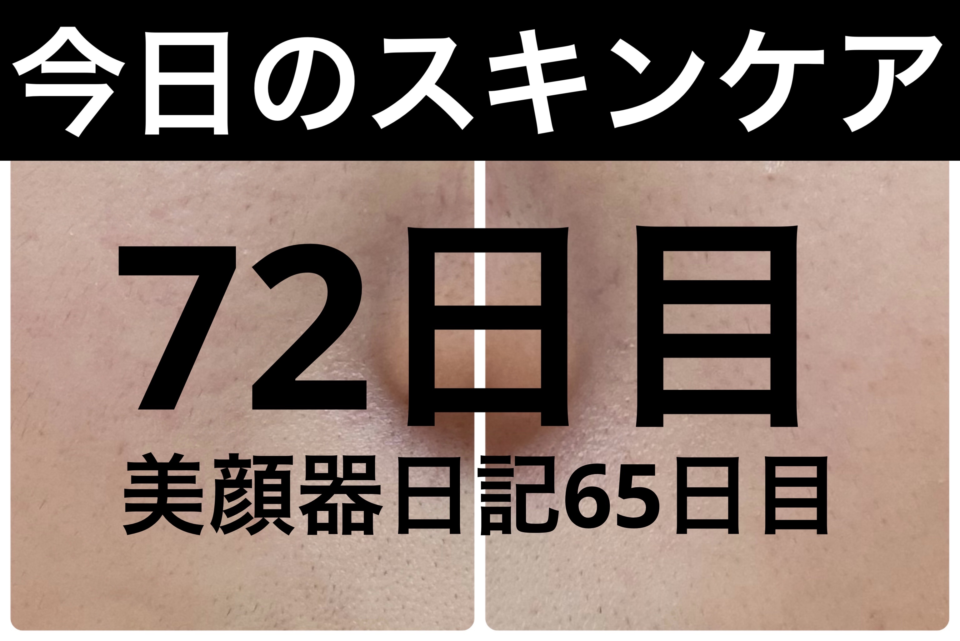 AGE-R ブースタープロ/MEDICUBE/美顔器・マッサージを使ったクチコミ（1枚目）