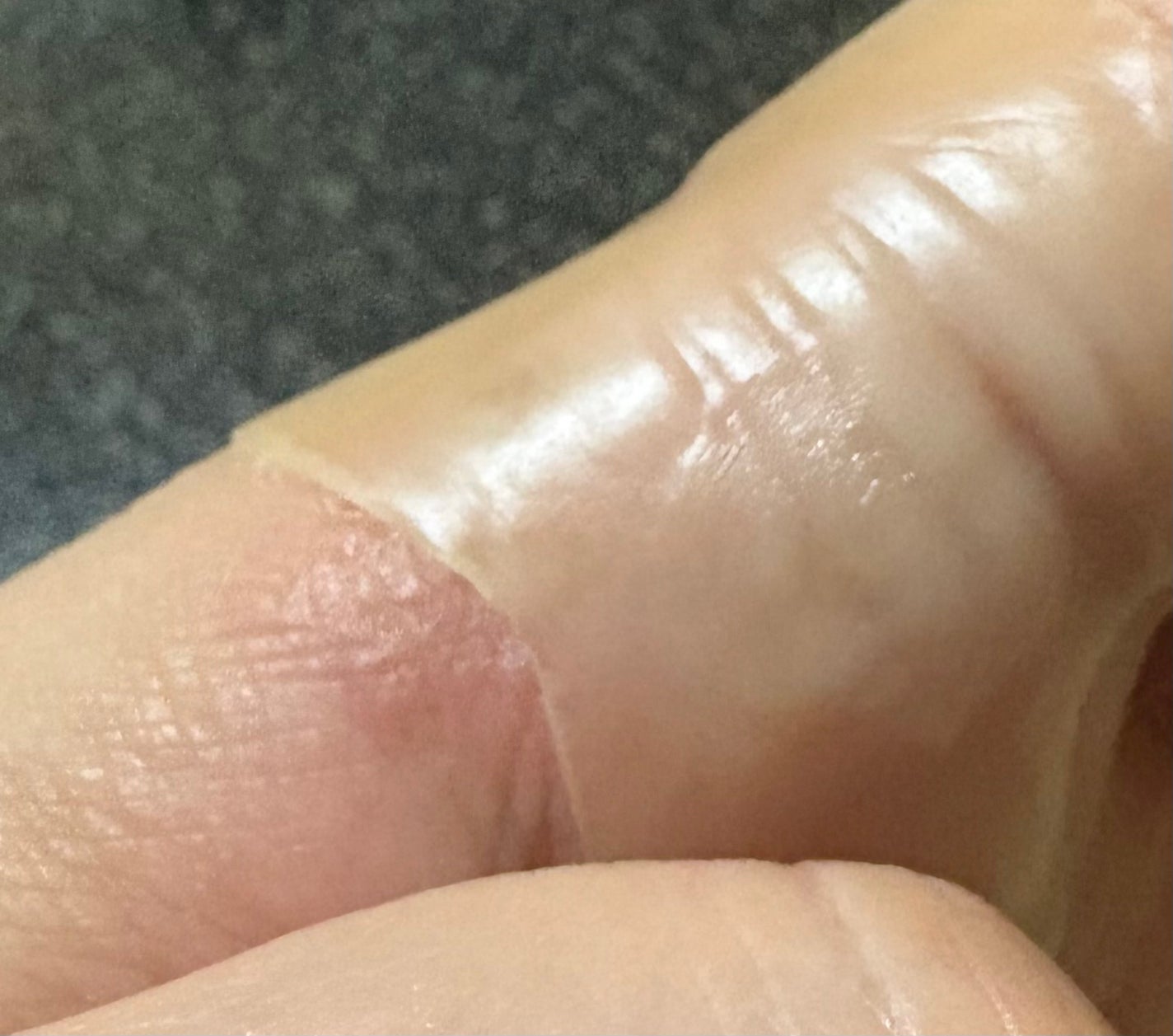 ヒビケア パッド/ヒビケア/その他を使ったクチコミ(3枚目)