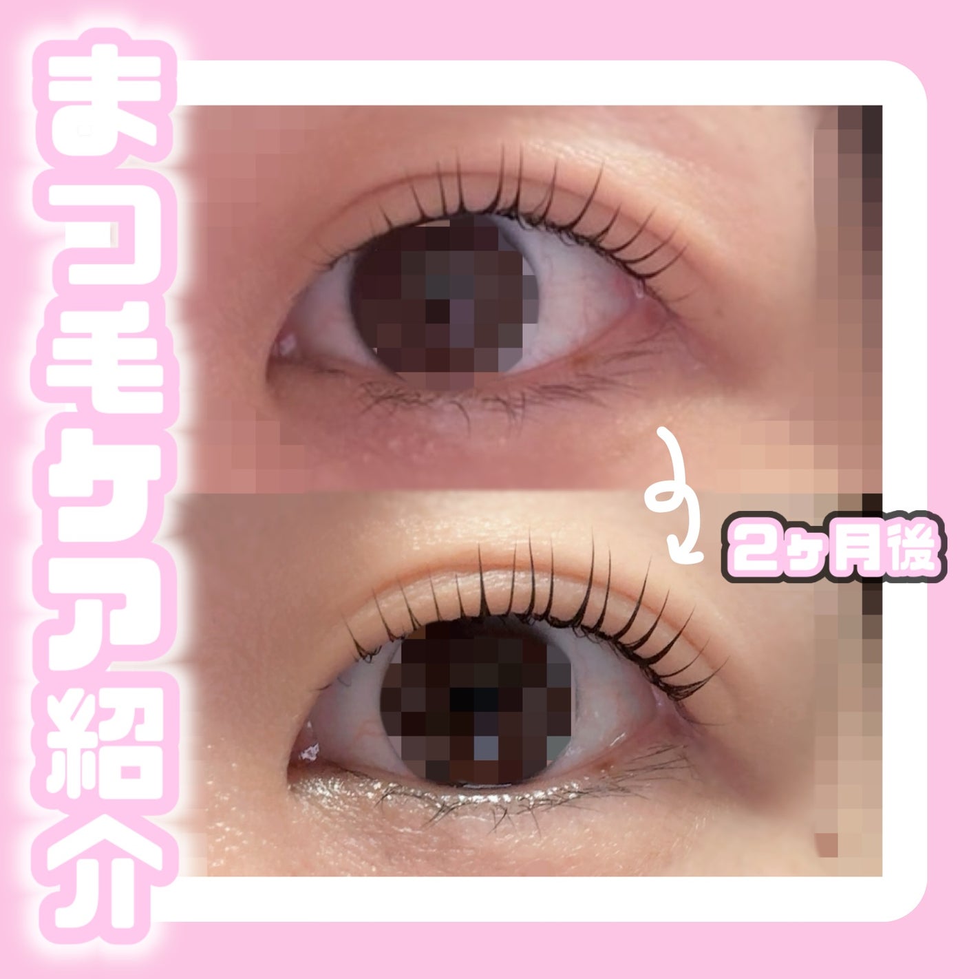 亜鉛/Dear-Natura (ディアナチュラ)/健康サプリメントを使ったクチコミ(1枚目)