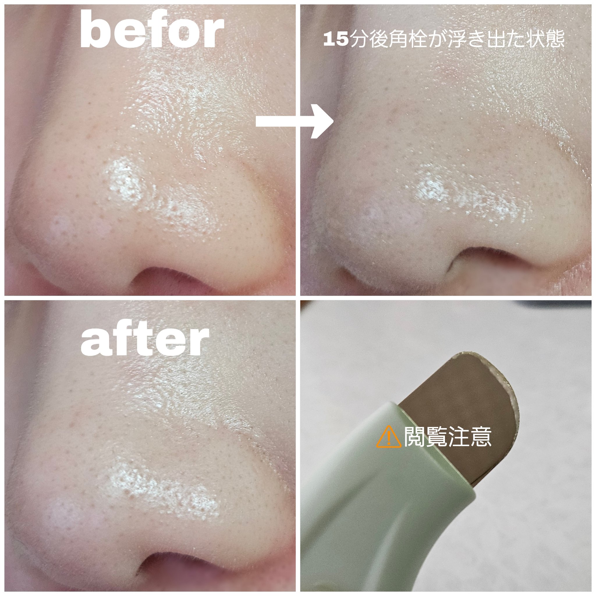 ディープクリーンマスター/ilso/その他スキンケアグッズを使ったクチコミ（2枚目）