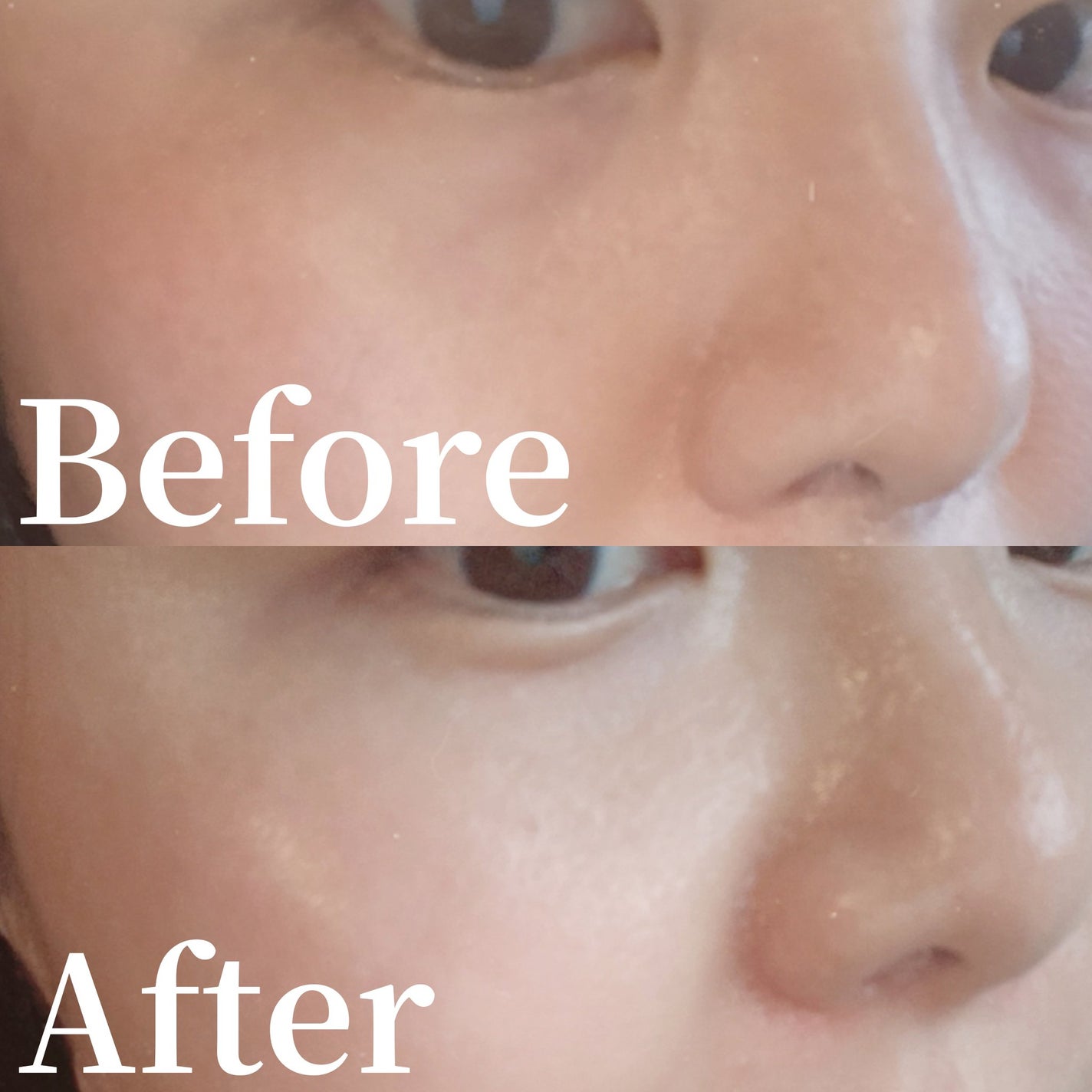 nakari ðŒ on LIPS ãSallyZenðð«§ã¹ãŒããŒAã·ã§ããã³ã³ãã¬ãã¯ã¹ãã¹ãð€³ð»..ãïŒ5æç®ïŒ