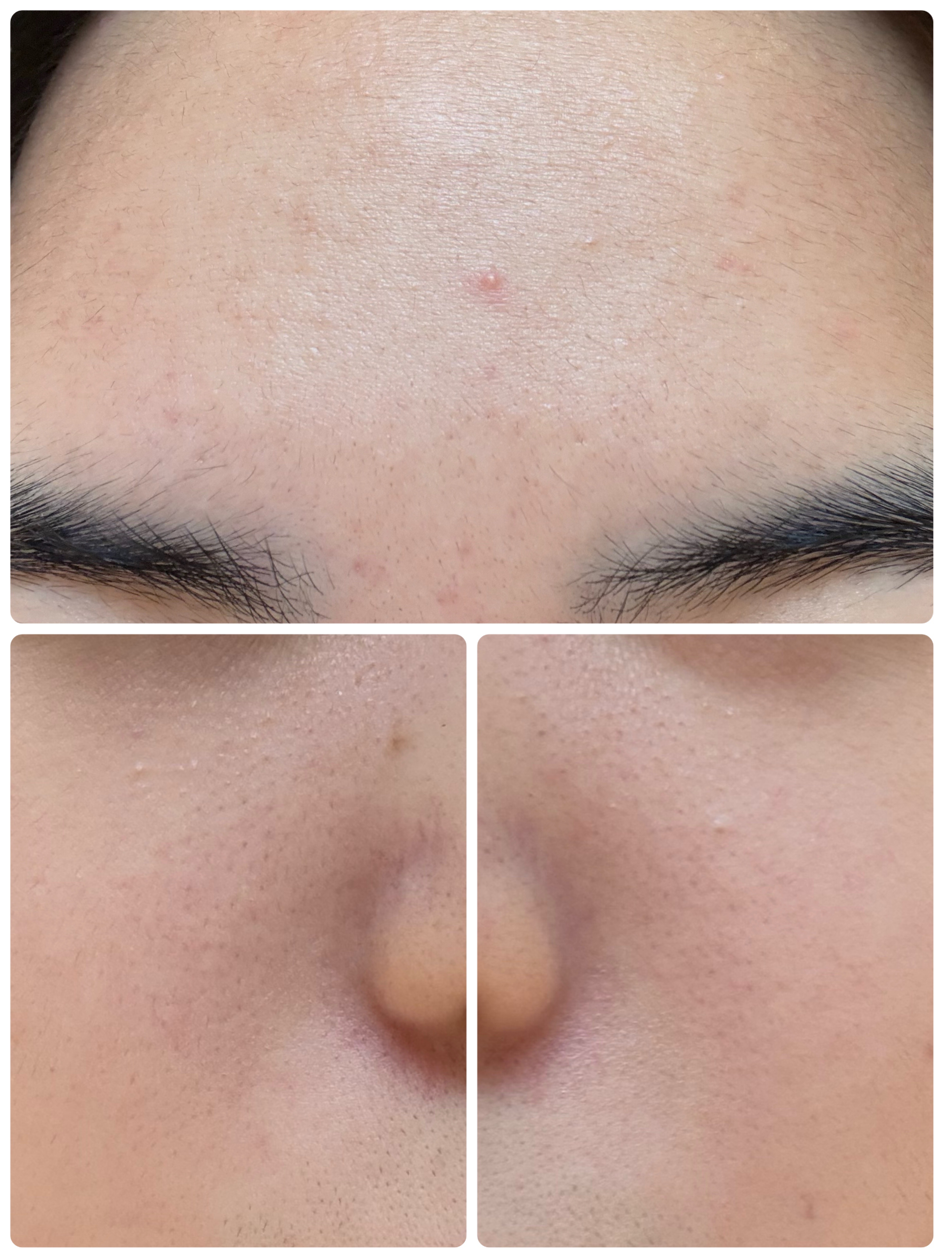 モーニングジェルウォッシュ/ビトレスキン/その他洗顔料を使ったクチコミ（3枚目）