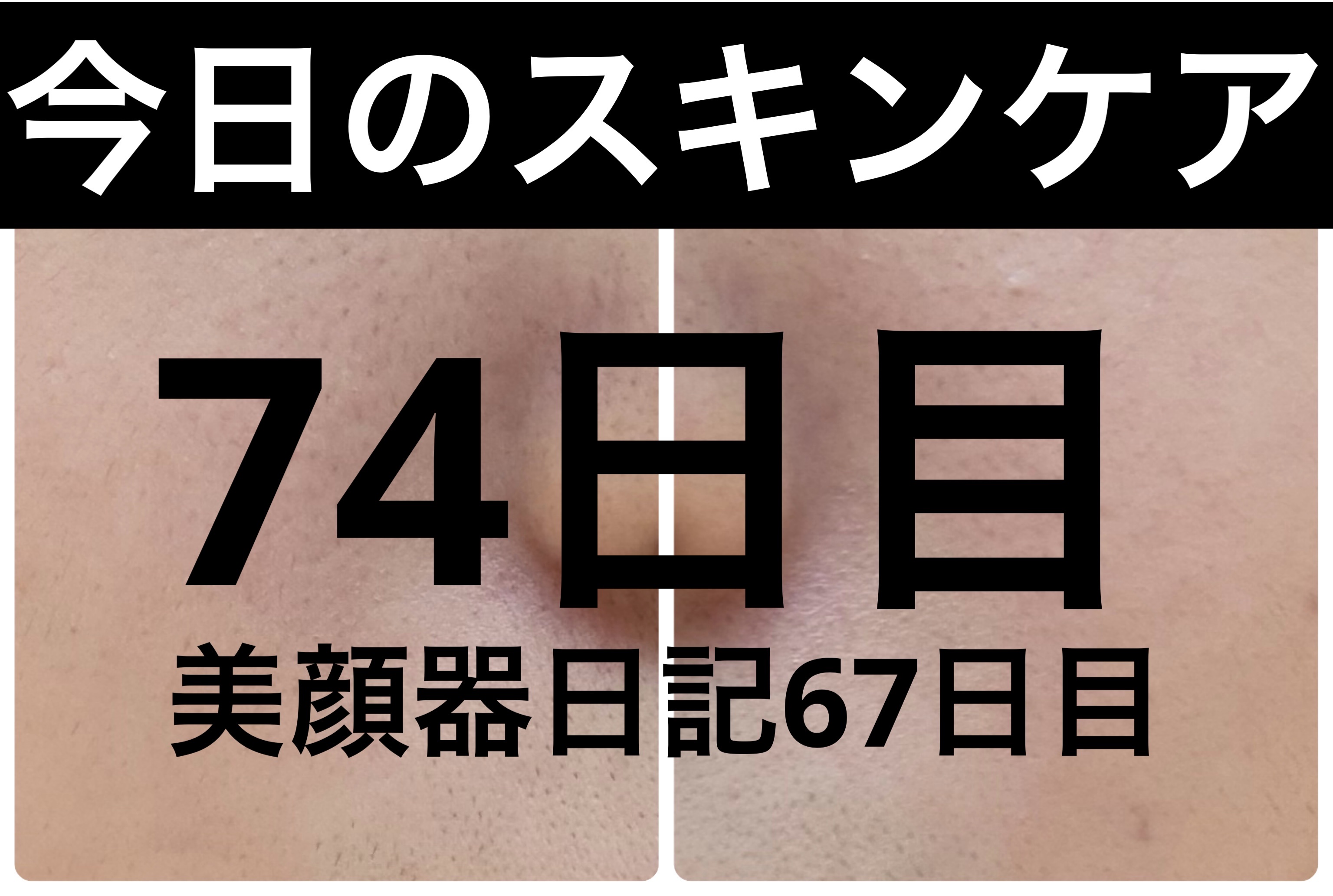 モーニングジェルウォッシュ/ビトレスキン/その他洗顔料を使ったクチコミ（1枚目）