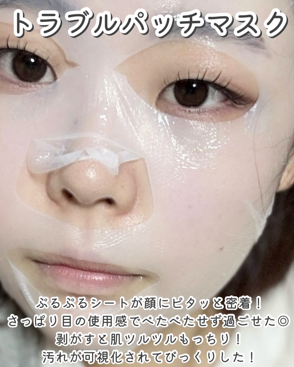 トラブルターゲティングセラム/EIOM/美容液を使ったクチコミ(4枚目)