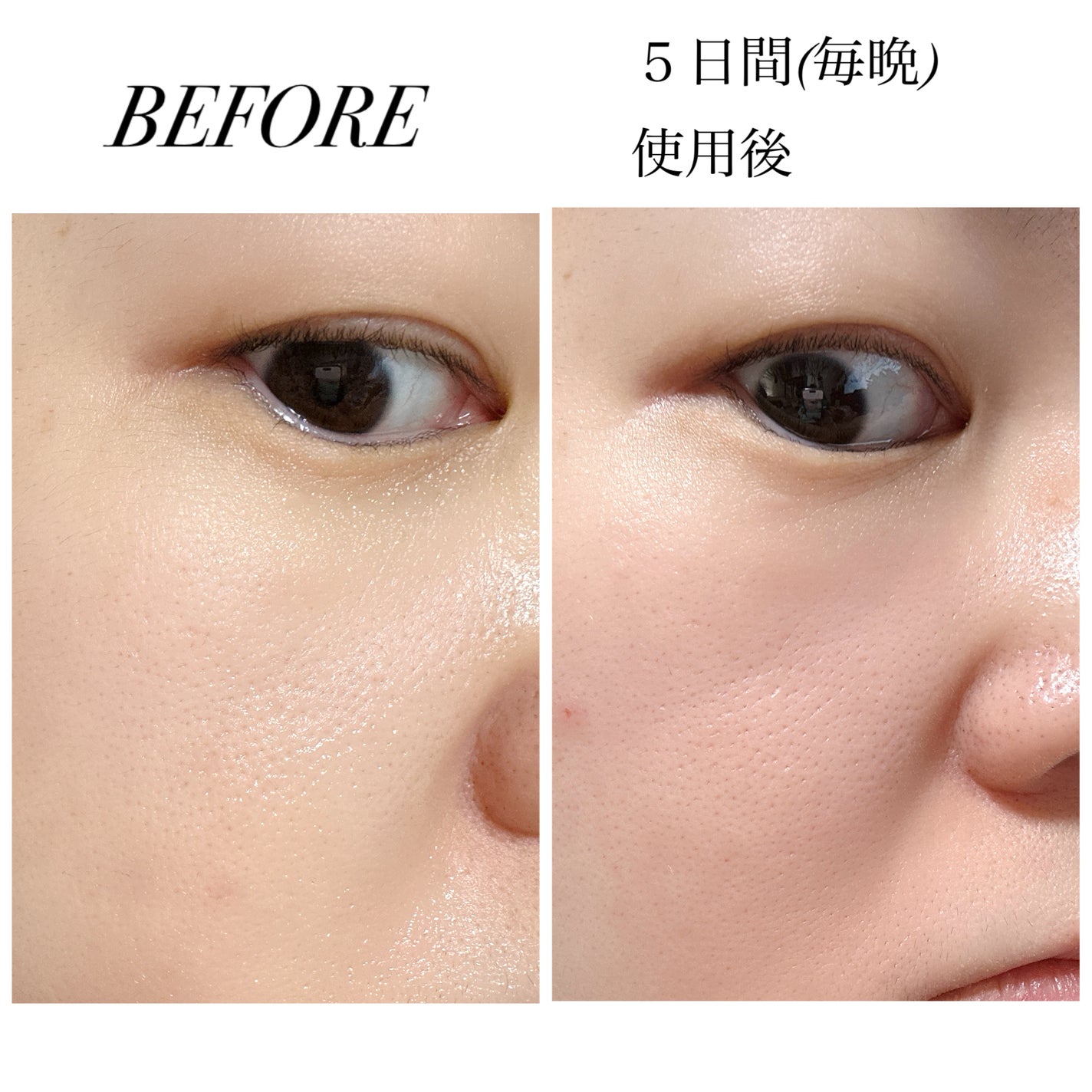 PDRN カプセルクリーム 100/VT/フェイスクリームを使ったクチコミ(9枚目)