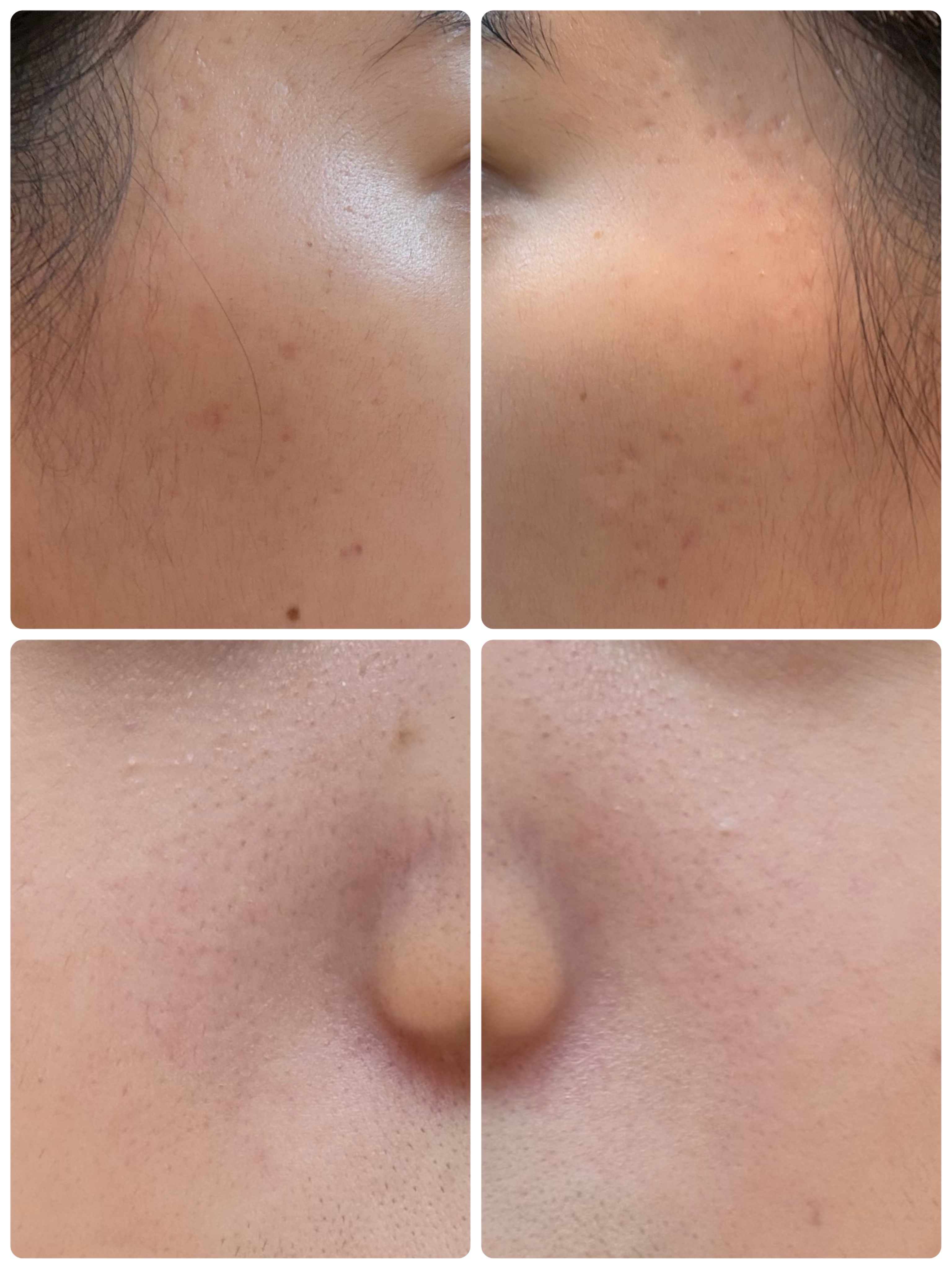 モーニングジェルウォッシュ/ビトレスキン/その他洗顔料を使ったクチコミ（2枚目）