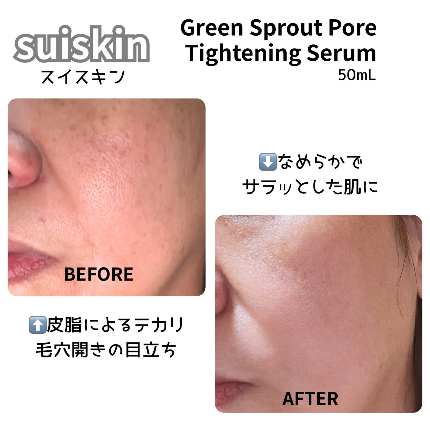 若芽ポアタイトニングセラム/suiskin/美容液を使ったクチコミ(5枚目)