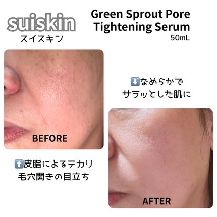 若芽ポアタイトニングセラム/suiskin/美容液を使ったクチコミ(5枚目)