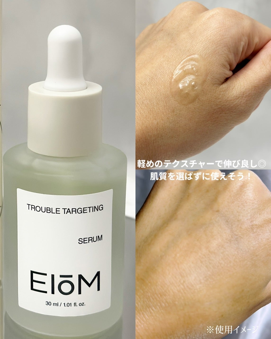 トラブルパッチマスク/EIOM/その他スキンケアを使ったクチコミ(3枚目)