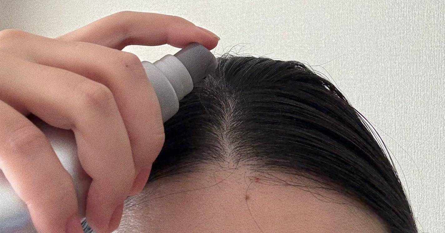 アデノバイタル スカルプ パワーショット/サブリミック/頭皮ローションを使ったクチコミ(2枚目)